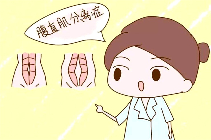 腹直肌分離問題，產(chǎn)后康復(fù)治療儀幫助您