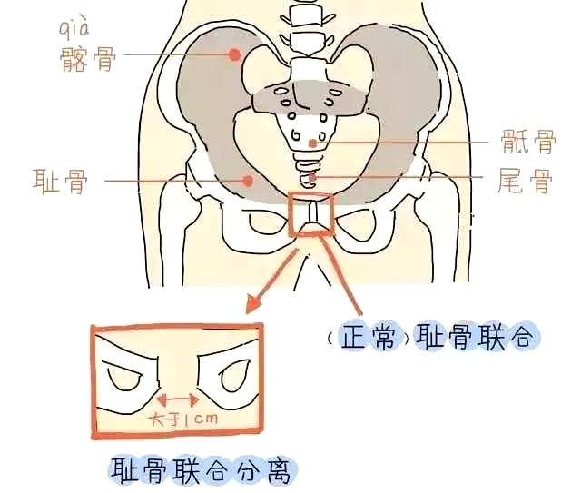 盆底肌康復(fù)治療儀，產(chǎn)后媽媽不再擔(dān)心