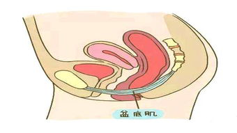 盆底肌康復(fù)治療儀，如何讓盆底肌康復(fù)評估報告更可靠