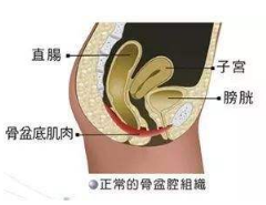 產(chǎn)后盆底肌怎么修復(fù)？你得做好盆底功能檢測(cè)
