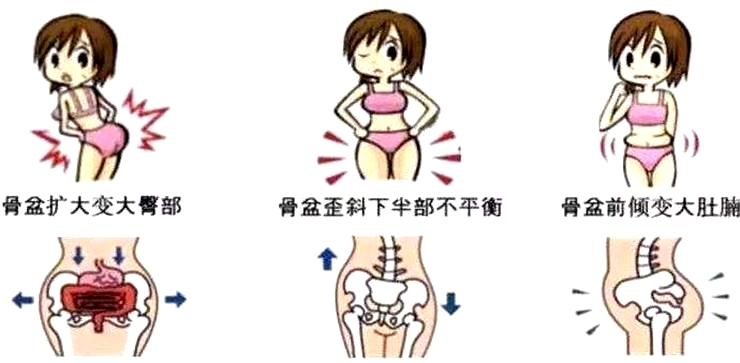 盆底康復(fù)治療怎么做，盆底治療儀是關(guān)鍵點(diǎn)