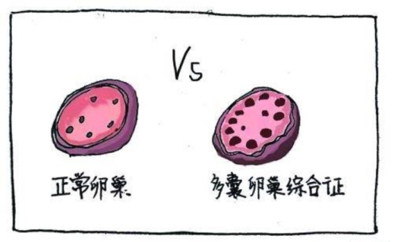 盆底肌康復治療怎么做，盆底肌修復十大常見問題（下）