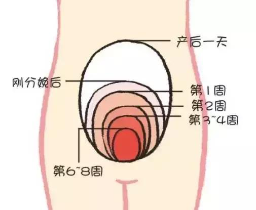 產后康復，什么叫子宮復舊不良？