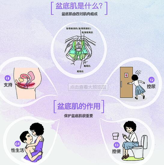 分析了1000個盆底肌治療案例，盆底功能檢測真的太重要了