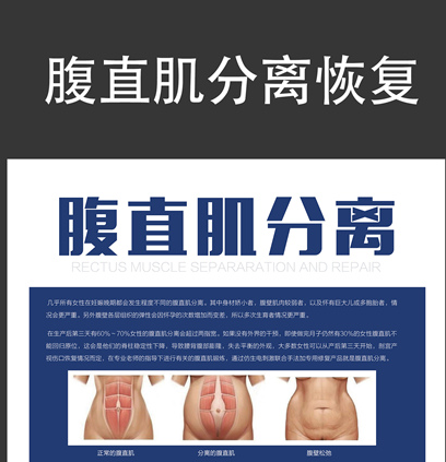 馬麗挺孕肚登春晚，孕婦還應(yīng)該知道腹直肌分離的相關(guān)知識