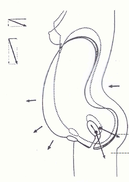 產康者腹直肌分離的理論知識不過關？你還怎么開展產后項目呢！