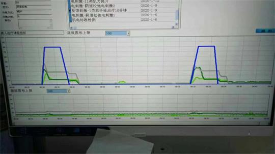 通澤子宮復舊治療儀器，痛經(jīng)不再是問題