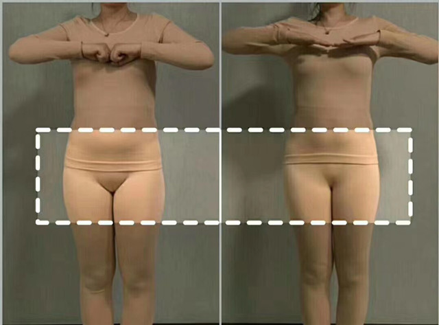女性產(chǎn)后子宮收縮不好，會(huì)給子宮留下后患之憂(yōu)，醫(yī)生媽媽建議早點(diǎn)使用子宮復(fù)舊儀