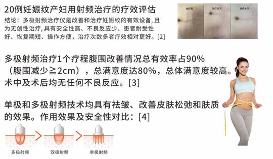 通澤產(chǎn)后塑形儀器，多極射頻破解辣媽逆齡秘訣