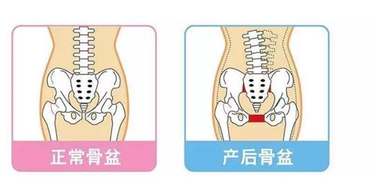 為什么每個(gè)成年女性都應(yīng)該堅(jiān)持訓(xùn)練盆底肌？