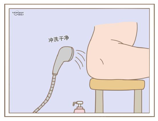     盆底恢復(fù)儀一般都是在什么時候使用？