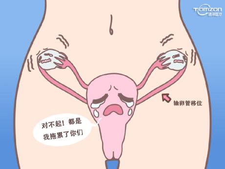 盆底康復(fù)治療儀有哪些常見的效果？