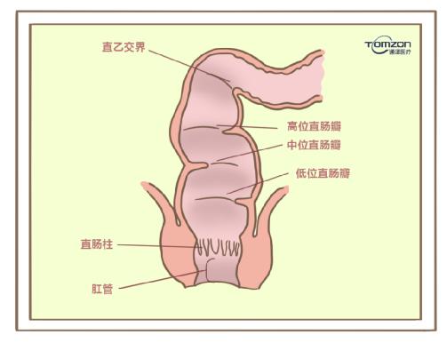 盆底康復(fù)治療儀對產(chǎn)后便秘有哪些幫助？