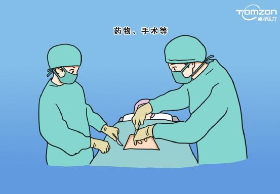 盆底治療儀應(yīng)該什么時(shí)候使用？