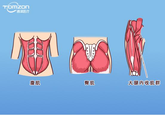 凱格爾運動該怎么做？盆底肌修復儀器還能用嗎？
