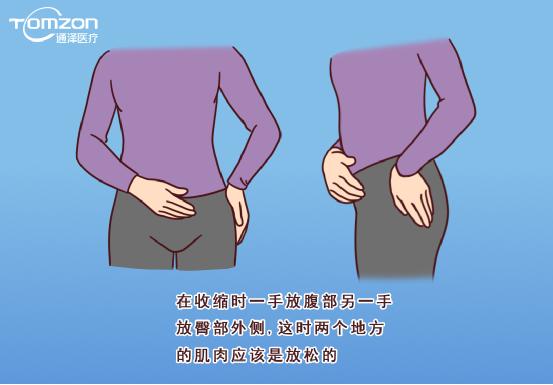 盆底康復治療儀能不能改善腹直肌分離？