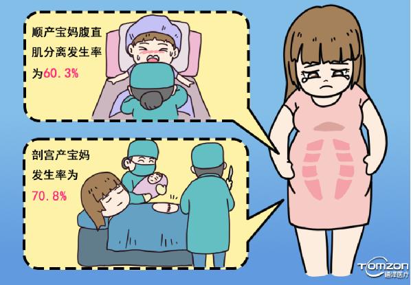 產(chǎn)后媽媽腹直肌發(fā)病率高，盆底肌修復儀器來幫你