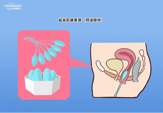 如有盆底高張者，不做力量提升型運(yùn)動(dòng)，否則容易加重盆底損傷。建議在做盆底康復(fù)運(yùn)動(dòng)前，先進(jìn)行盆底肌肉檢測