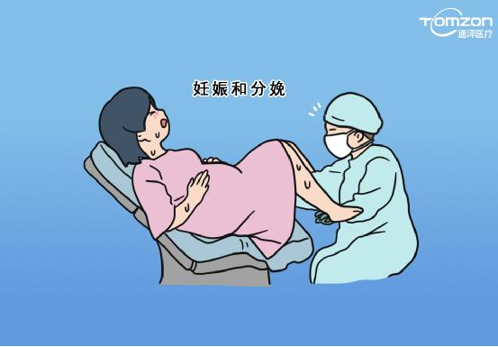 盆底康復(fù)治療儀是否可以促進(jìn)盆底肌肉康復(fù)？