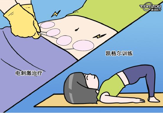 產(chǎn)后便秘怎么辦？盆底肌修復(fù)儀器來治療