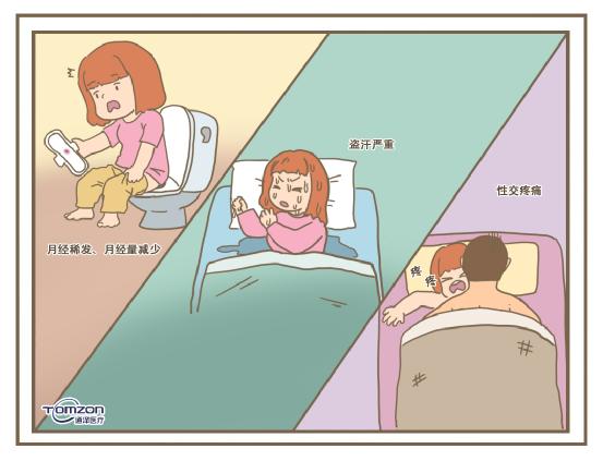 使用盆底肌康復儀必要嗎？