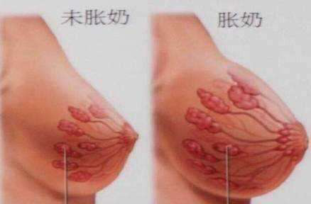 產后康復
