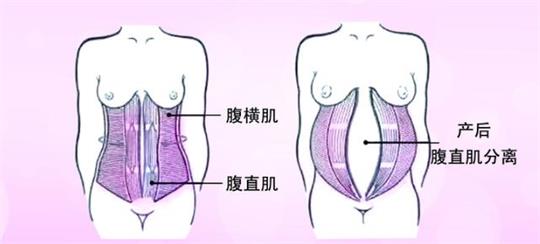 產后恢復